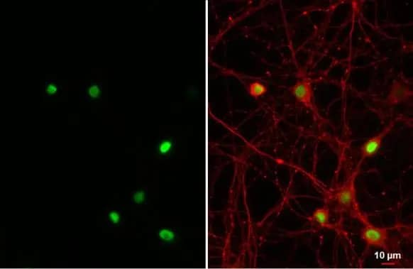 Immunocytochemistry/Immunofluorescence: NFIX Antibody (HL1269) - Azide and BSA Free [NBP3-25576] - NFIX antibody [HL1269] detects NFIX protein at nucleus by immunofluorescent analysis. Sample: DIV10 rat E18 primary hippocampal neuron and glia cells were fixed in 4% paraformaldehyde at RT for 15 min. Green: NFIX stained by NFIX antibody [HL1269] (NBP3-25576) diluted at 1:250. Red: Tau, a cytoskeleton marker, stained by Tau antibody [GT287] diluted at 1:500.