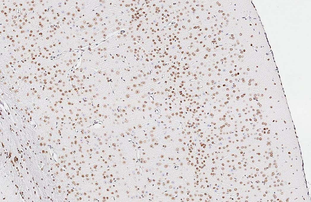 NFIX antibody [HL1269] detects NFIX protein by immunohistochemical analysis.Sample: Paraffin-embedded mouse brain.NFIX stained by NFIX antibody [HL1269] (NBP3-25576) diluted at 1:800.Antigen Retrieval: Citrate buffer, pH 6.0, 15 min 