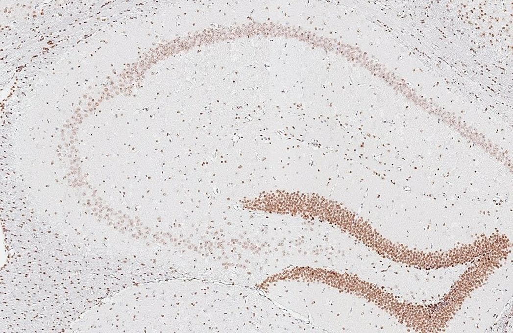 NFIX antibody [HL1269] detects NFIX protein by immunohistochemical analysis.Sample: Paraffin-embedded mouse hippocampus.NFIX stained by NFIX antibody [HL1269] (NBP3-25576) diluted at 1:800.Antigen Retrieval: Citrate buffer, pH 6.0, 15 min 