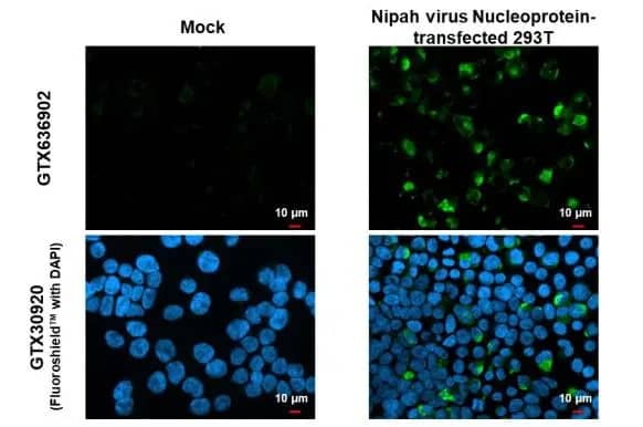 Immunocytochemistry/Immunofluorescence: Nipah Virus Nucleoprotein Antibody (HL1436) - Azide and BSA Free [NBP3-25577] - Nipah virus Nucleoprotein antibody [HL1436] detects Nipah virus Nucleoprotein protein by immunofluorescent analysis. Sample: Mock and transfected 293T cells were fixed in 4% paraformaldehyde at RT for 15 min. Green: Nipah virus Nucleoprotein stained by Nipah virus Nucleoprotein antibody [HL1436] (NBP3-25577) diluted at 1:500. Blue: Fluoroshield with DAPI .