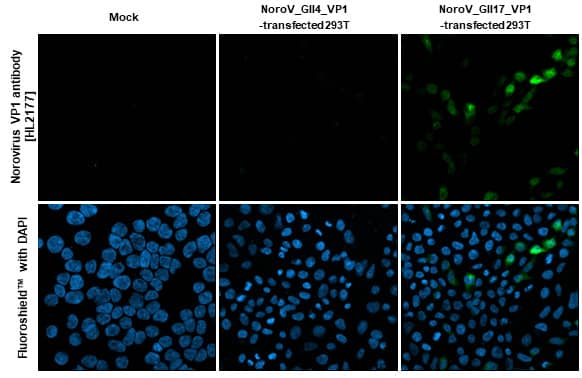 Immunocytochemistry/Immunofluorescence: Norovirus VP1 Antibody (HL2177) - Azide and BSA Free [NBP3-25579] - Norovirus VP1 antibody [HL2177] detects Norovirus VP1 protein by immunofluorescent analysis. Sample: Mock and transfected 293T cells were fixed in 4% paraformaldehyde at RT for 15 min. Green: Norovirus VP1 stained by Norovirus VP1 antibody [HL2177] (NBP3-25579) diluted at 1:500. Blue: Fluoroshield with DAPI .