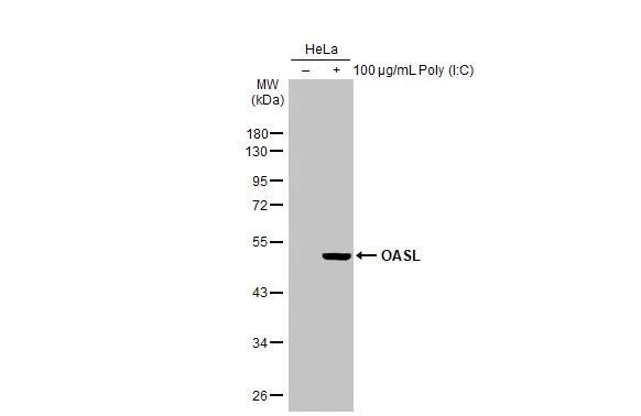 Western Blot: OASL Antibody (HL2399) - Azide and BSA Free [NBP3-25583] - Untreated (-) and treated (+) HeLa whole cell extracts (30 ug) were separated by 10% SDS-PAGE, and the membrane was blotted with OASL antibody [HL2399] (NBP3-25583) diluted at 1:1000. The HRP-conjugated anti-rabbit IgG antibody was used to detect the primary antibody.