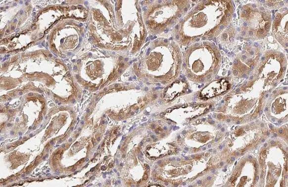 OASL antibody [HL2399] detects OASL protein at cytoplasm by immunohistochemical analysis.Sample: Paraffin-embedded rat kidney.OASL stained by OASL antibody [HL2399] (NBP3-25583) diluted at 1:100.Antigen Retrieval: Citrate buffer, pH 6.0, 15 min 