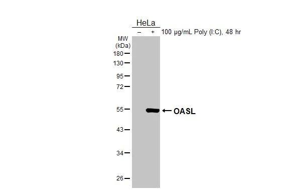 <b>Orthogonal Strategies Validation. </b>Untreated (-) and treated (+) HeLa whole cell extract (30 ug) were separated by 10% SDS-PAGE, and the membrane was blotted with OASL antibody [HL2399] (NBP3-25583) diluted at 1:1000. The HRP-conjugated anti-rabbit IgG antibody was used to detect the primary antibody. 