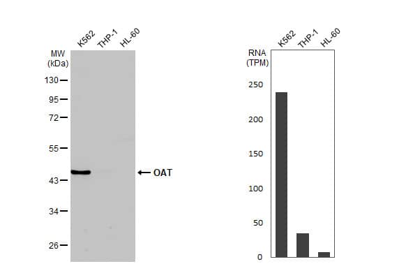 <b>Orthogonal Strategies Validation. </b>Various whole cell extracts (30 ug) were separated by 10% SDS-PAGE, and the membrane was blotted with OAT antibody [HL2087] (NBP3-25584) diluted at 1:1000. The HRP-conjugated anti-rabbit IgG antibody was used to detect the primary antibody, and the signal was developed with Trident ECL plus-Enhanced. Corresponding RNA expression data for the same cell lines are based on Human Protein Atlas program. 