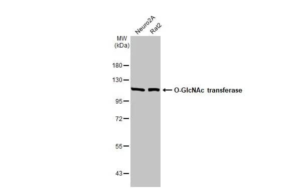 Western Blot: O-GlcNAc Transferase p110 subunit Antibody (HL1641) - Azide and BSA Free [NBP3-25586] - Various whole cell extracts (30 ug) were separated by 7.5% SDS-PAGE, and the membrane was blotted with O-GlcNAc transferase antibody [HL1641] (NBP3-25586) diluted at 1:1000. The HRP-conjugated anti-rabbit IgG antibody was used to detect the primary antibody.