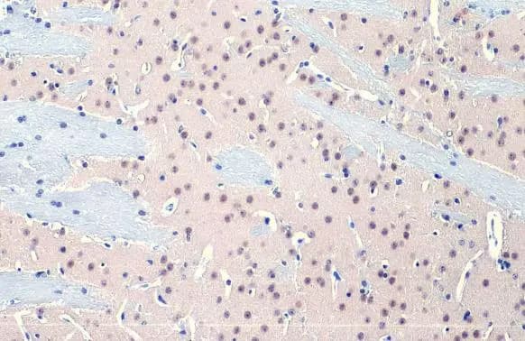 Immunohistochemistry-Paraffin: O-GlcNAc Transferase p110 subunit Antibody (HL1641) - Azide and BSA Free [NBP3-25586] - O-GlcNAc transferase antibody [HL1641] detects O-GlcNAc transferase protein at nucleus by immunohistochemical analysis. Sample: Paraffin-embedded mouse brain. O-GlcNAc transferase stained by O-GlcNAc transferase antibody [HL1641] (NBP3-25586) diluted at 1:100. Antigen Retrieval: Citrate buffer, pH 6.0, 15 min