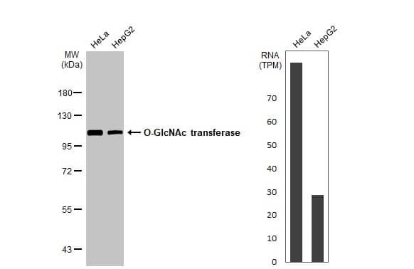 <b>Orthogonal Strategies Validation. </b>Various whole cell extracts (30 ug) were separated by 7.5% SDS-PAGE, and the membrane was blotted with O-GlcNAc Transferase p110 subunit antibody [HL1641] (NBP3-25586) diluted at 1:1000. The HRP-conjugated anti-rabbit IgG antibody was used to detect the primary antibody. Corresponding RNA expression data for the same cell lines are based on Human Protein Atlas program. 