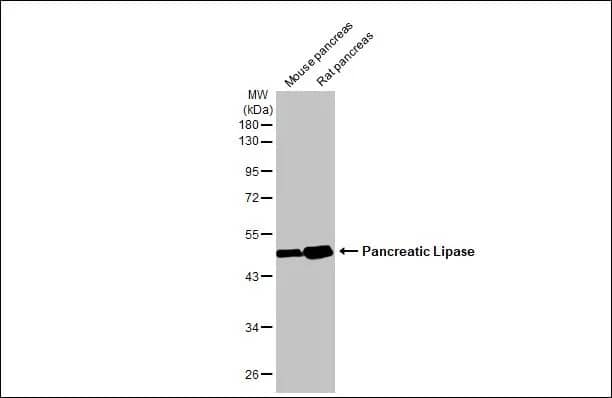 Western Blot: Pancreatic Lipase Antibody (HL1310) - Azide and BSA Free [NBP3-25590] - Various tissue extracts (50 ug) were separated by 10% SDS-PAGE, and the membrane was blotted with Pancreatic Lipase antibody [HL1310] (NBP3-25590) diluted at 1:100000. The HRP-conjugated anti-rabbit IgG antibody was used to detect the primary antibody.