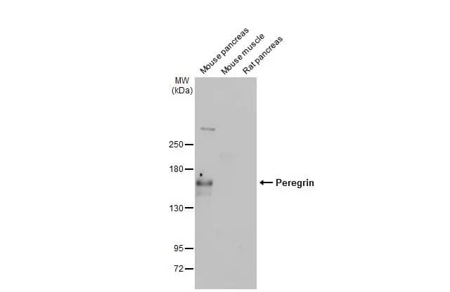 <b>Orthogonal Strategies Validation. </b>Western Blot: BRPF1 Antibody (HL2064) - Azide and BSA Free [NBP3-25595] - Various tissue extracts (50 ug) were separated by 5% SDS-PAGE, and the membrane was blotted with Peregrin antibody [HL2064] (NBP3-25595) diluted at 1:1000. The HRP-conjugated anti-rabbit IgG antibody was used to detect the primary antibody, and the signal was developed with Trident ECL plus-Enhanced.