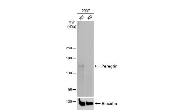 <b>Genetic Strategies Validation. </b>Knockout Validated: BRPF1 Antibody (HL2064) - Azide and BSA Free [NBP3-25595] - Wild-type (WT) and BRPF1 knockout (KO) 293T cell extracts (5 ug) were separated by 5% SDS-PAGE, and the membrane was blotted with Peregrin antibody [HL2064] (NBP3-25595) diluted at 1:1000. The HRP-conjugated anti-rabbit IgG antibody was used to detect the primary antibody, and the signal was developed with Trident femto Western HRP Substrate.