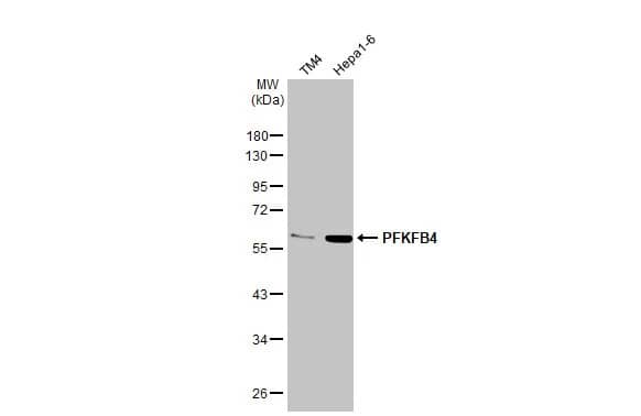 Western Blot: PFKFB4 Antibody (HL2204) - Azide and BSA Free [NBP3-25598] - Various whole cell extracts (30 ug) were separated by 10% SDS-PAGE, and the membrane was blotted with PFKFB4 antibody [HL2204] (NBP3-25598) diluted at 1:1000. The HRP-conjugated anti-rabbit IgG antibody was used to detect the primary antibody.