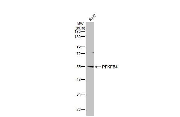 Western Blot: PFKFB4 Antibody (HL2204) - Azide and BSA Free [NBP3-25598] - Whole cell extract (30 ug) was separated by 10% SDS-PAGE, and the membrane was blotted with PFKFB4 antibody [HL2204] (NBP3-25598) diluted at 1:1000. The HRP-conjugated anti-rabbit IgG antibody was used to detect the primary antibody.