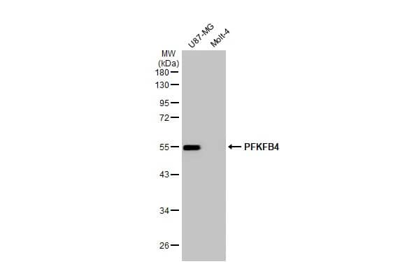 Western Blot: PFKFB4 Antibody (HL2204) - Azide and BSA Free [NBP3-25598] - Various whole cell extracts (30 ug) were separated by 10% SDS-PAGE, and the membrane was blotted with PFKFB4 antibody [HL2204] (NBP3-25598) diluted at 1:1000. The HRP-conjugated anti-rabbit IgG antibody was used to detect the primary antibody.
