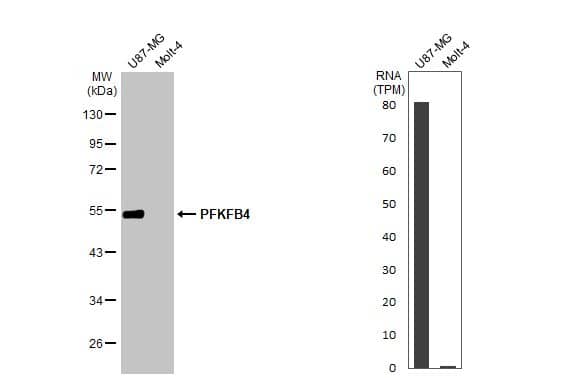 <b>Orthogonal Strategies Validation. </b>Western Blot: PFKFB4 Antibody (HL2204) - Azide and BSA Free [NBP3-25598] - Various whole cell extracts (30 ug) were separated by 10% SDS-PAGE, and the membrane was blotted with PFKFB4 antibody [HL2204] (NBP3-25598) diluted at 1:1000. The HRP-conjugated anti-rabbit IgG antibody was used to detect the primary antibody, and the signal was developed with Trident ECL plus-Enhanced. Corresponding RNA expression data for the same cell lines are based on Human Protein Atlas program.
