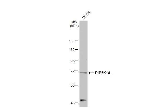 Western Blot: PIP5K1 alpha Antibody (HL2011) - Azide and BSA Free [NBP3-25603] - Whole cell extract (30 ug) was separated by 7.5% SDS-PAGE, and the membrane was blotted with PIP5K1A antibody [HL2011] (NBP3-25603) diluted at 1:1000. The HRP-conjugated anti-rabbit IgG antibody was used to detect the primary antibody.