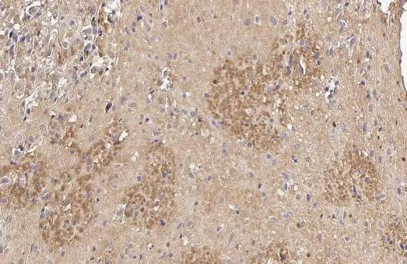 Immunohistochemistry-Paraffin: PIP5K1 alpha Antibody (HL2011) - Azide and BSA Free [NBP3-25603] - PIP5K1A antibody [HL2011] detects PIP5K1A protein at cytoplasm and nucleus by immunohistochemical analysis. Sample: Paraffin-embedded cat spleen. PIP5K1A stained by PIP5K1A antibody [HL2011] (NBP3-25603) diluted at 1:100. Antigen Retrieval: Citrate buffer, pH 6.0, 15 min