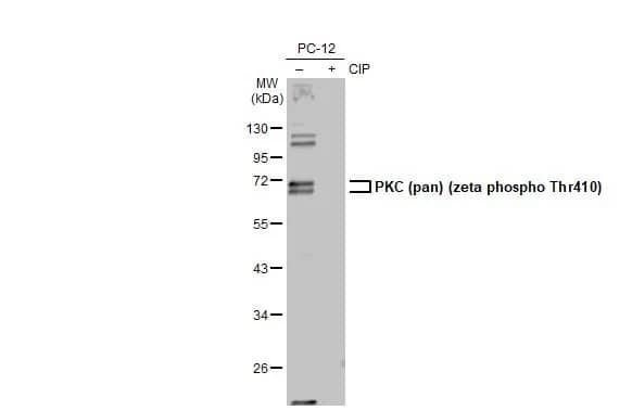 Western Blot: pan PKC [p Thr410] Antibody (HL1278) - Azide and BSA Free [NBP3-25604] - Untreated (-) and treated (+) PC-12 whole cell extracts (30 ug) were separated by 10% SDS-PAGE, and the membrane was blotted with PKC (pan) (zeta phospho Thr410) antibody [HL1278] (NBP3-25604) diluted at 1:1000. The HRP-conjugated anti-rabbit IgG antibody was used to detect the primary antibody, and the signal was developed with Trident ECL plus-Enhanced.