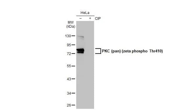 Western Blot: pan PKC [p Thr410] Antibody (HL1278) - Azide and BSA Free [NBP3-25604] - Untreated (-) and treated (+) HeLa whole cell extracts (30 ug) were separated by 10% SDS-PAGE, and the membrane was blotted with PKC (pan) (zeta phospho Thr410) antibody [HL1278] (NBP3-25604) diluted at 1:1000. The HRP-conjugated anti-rabbit IgG antibody was used to detect the primary antibody.