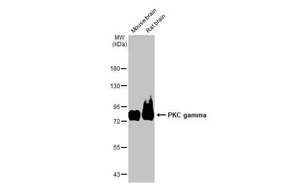 Western Blot: PKC gamma Antibody (HL2226) - Azide and BSA Free [NBP3-25606] - Various tissue extracts (50 ug) were separated by 7.5% SDS-PAGE, and the membrane was blotted with PKC gamma antibody [HL2226] (NBP3-25606) diluted at 1:5000. The HRP-conjugated anti-rabbit IgG antibody was used to detect the primary antibody.