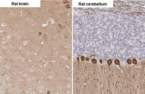 Immunohistochemistry-Paraffin: PKC gamma Antibody (HL2226) - Azide and BSA Free [NBP3-25606] - PKC gamma antibody [HL2226] detects PKC gamma protein by immunohistochemical analysis. Sample: Paraffin-embedded rat tissues. PKC gamma stained by PKC gamma antibody [HL2226] (NBP3-25606) diluted at 1:100. Antigen Retrieval: Citrate buffer, pH 6.0, 15 min