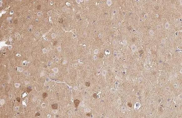 Immunohistochemistry-Paraffin: PKC gamma Antibody (HL2226) - Azide and BSA Free [NBP3-25606] - PKC gamma antibody [HL2226] detects PKC gamma protein at cell membrane and cytoplasm by immunohistochemical analysis. Sample: Paraffin-embedded mouse brain. PKC gamma stained by PKC gamma antibody [HL2226] (NBP3-25606) diluted at 1:100. Antigen Retrieval: Citrate buffer, pH 6.0, 15 min