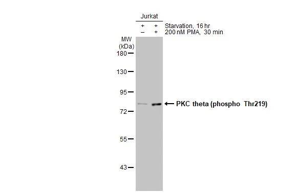 <b>Biological Strategies Validation and Orthogonal Strategies Validation.</b>Untreated (-) and treated (+) Jurkat whole cell extracts (30 ug) were separated by 7.5% SDS-PAGE, and the membrane was blotted with PKC theta antibody [HL1157] (NBP3-25607) diluted at 1:1000. The HRP-conjugated anti-rabbit IgG antibody was used to detect the primary antibody. 