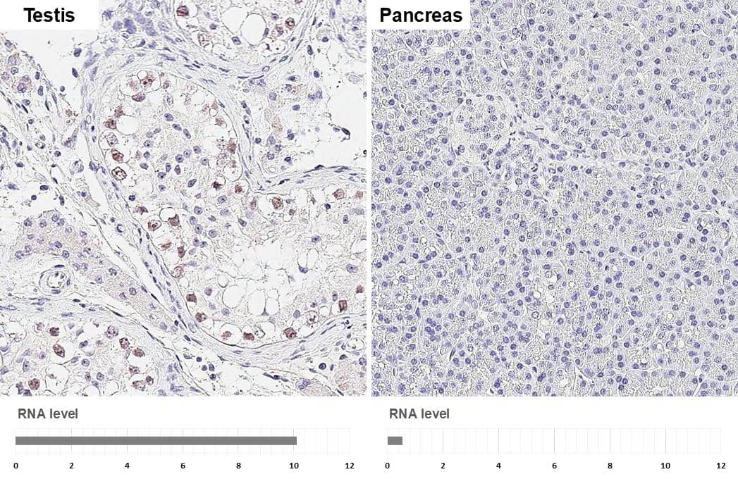 <b>Orthogonal Strategies Validation. </b>DNA Polymerase epsilon catalytic subunit A antibody [HL2150] detects DNA Polymerase epsilon catalytic subunit A protein by immunohistochemical analysis.Sample: Paraffin-embedded human tissues.DNA Polymerase epsilon catalytic subunit A stained by DNA Polymerase epsilon catalytic subunit A antibody [HL2150] (NBP3-25609) diluted at 1:200.Antigen Retrieval: Citrate buffer, pH 6.0, 15 min 