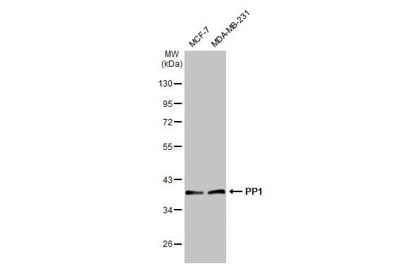 Western Blot: PP1 Antibody (HL1677) - Azide and BSA Free [NBP3-25610] - Various whole cell extracts (30 ug) were separated by 10% SDS-PAGE, and the membrane was blotted with PP1 antibody [HL1677] (NBP3-25610) diluted at 1:1000. The HRP-conjugated anti-rabbit IgG antibody was used to detect the primary antibody.