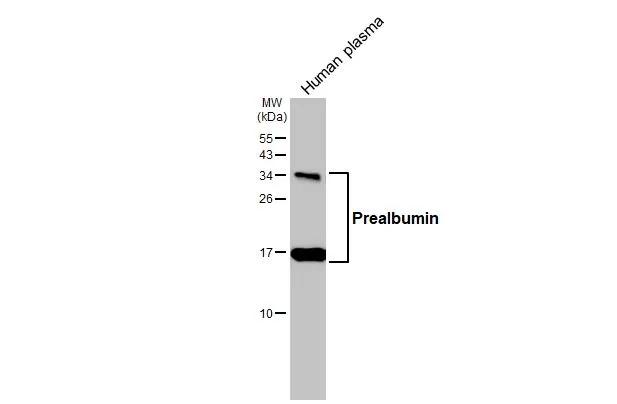 Human plasma (30 ug) was separated by 15% SDS-PAGE, and the membrane was blotted with Transthyretin/Prealbumin antibody [HL1823] (NBP3-25613) diluted at 1:1000. The HRP-conjugated anti-rabbit IgG antibody was used to detect the primary antibody. 
