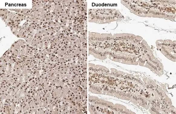 Immunohistochemistry-Paraffin: Rad21 Antibody (HL2171) - Azide and BSA Free [NBP3-25619] - Rad21 antibody [HL2171] detects Rad21 protein by immunohistochemical analysis. Sample: Paraffin-embedded rat tissues. Rad21 stained by Rad21 antibody [HL2171] (NBP3-25619) diluted at 1:50. Antigen Retrieval: Citrate buffer, pH 6.0, 15 min