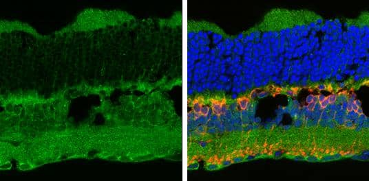 P2X7/P2RX7 antibody detects P2X7/P2RX7 protein by immunohistochemical analysis.Sample: Frozen sectioned adult mouse retina. Green: P2X7/P2RX7 protein stained by P2X7/P2RX7 antibody (NBP1-32470) diluted at 1:250.Red: Protein kinase C alpha staining.Blue: Fluoroshield with DAPI .Antigen Retrieval: Citrate buffer, pH 6.0, 15 min 