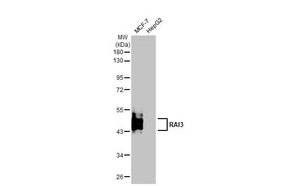 Western Blot: GPRC5A/RAI3 Antibody (HL1864) - Azide and BSA Free [NBP3-25620] - Various whole cell extracts (30 ug) were separated by 10% SDS-PAGE, and the membrane was blotted with RAI3 antibody [HL1864] (NBP3-25620) diluted at 1:1000. The HRP-conjugated anti-rabbit IgG antibody was used to detect the primary antibody, and the signal was developed with Trident ECL plus-Enhanced.
