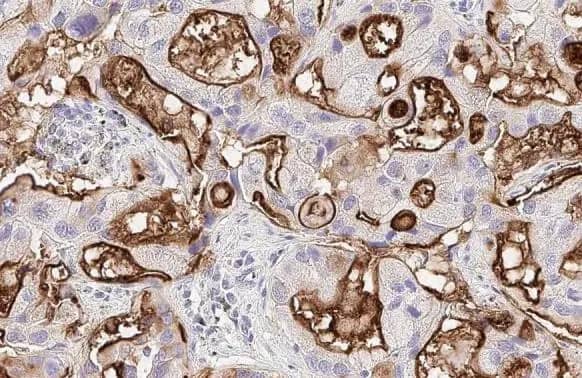 Immunohistochemistry-Paraffin GPRC5A/RAI3 Antibody (HL1864) - Azide and BSA Free