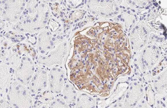 Immunohistochemistry-Paraffin: GPRC5A/RAI3 Antibody (HL1864) - Azide and BSA Free [NBP3-25620] - RAI3 antibody [HL1864] detects RAI3 protein at cell membrane by immunohistochemical analysis. Sample: Paraffin-embedded human kidney. RAI3 stained by RAI3 antibody [HL1864] (NBP3-25620) diluted at 1:200. Antigen Retrieval: Citrate buffer, pH 6.0, 15 min