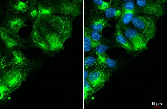 GPRC5A/RAI3 antibody [HL1864] detects GPRC5A/RAI3 protein at cell membrane by immunofluorescent analysis.Sample: MCF-7 cells were fixed in ice-cold MeOH for 5 min.Green: GPRC5A/RAI3 stained by GPRC5A/RAI3 antibody [HL1864] (NBP3-25620) diluted at 1:500.Blue: Fluoroshield with DAPI . 