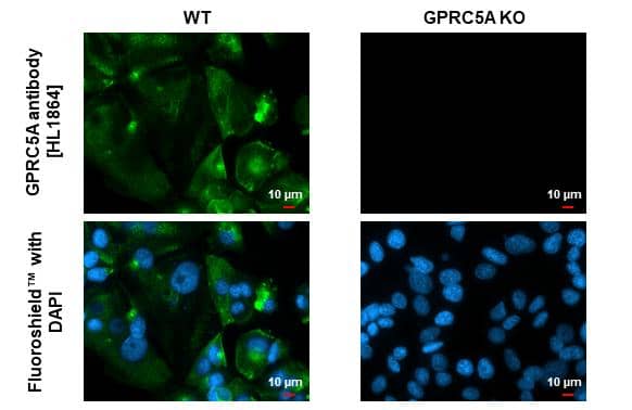 <b>Genetic Strategies Validation. </b>GPRC5A/RAI3 antibody [HL1864] detects GPRC5A/RAI3 protein by immunofluorescent analysis.Sample: Wild-type (WT) and GPRC5A/RAI3 knockout (KO) MCF-7 cells were fixed in ice-cold MeOH for 5 min.Green: GPRC5A/RAI3 stained by GPRC5A/RAI3 antibody [HL1864] (NBP3-25620) diluted at 1:500.Blue: Fluoroshield with DAPI 