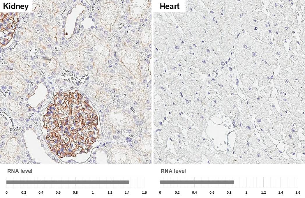 <b>Orthogonal Strategies Validation. </b>GPRC5A/RAI3 antibody [HL1864] detects GPRC5A/RAI3 protein by immunohistochemical analysis.Sample: Paraffin-embedded human tissues.GPRC5A/RAI3 stained by GPRC5A/RAI3 antibody [HL1864] (NBP3-25620) diluted at 1:100.Antigen Retrieval: Citrate buffer, pH 6.0, 15 min 