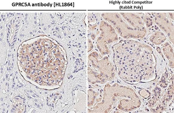 <b>Independent Antibodies Validation. </b>GPRC5A/RAI3 antibody [HL1864] detects GPRC5A/RAI3 protein by immunohistochemical analysis.Sample: Paraffin-embedded human kidney.GPRC5A/RAI3 stained by GPRC5A/RAI3 antibody [HL1864] (NBP3-25620) diluted at 1:100 and highly cited competitor's antibody diluted at 1:100.Antigen Retrieval: Citrate buffer, pH 6.0, 15 min*Competitor's antibody is not affiliated withand does not endorse this product. 