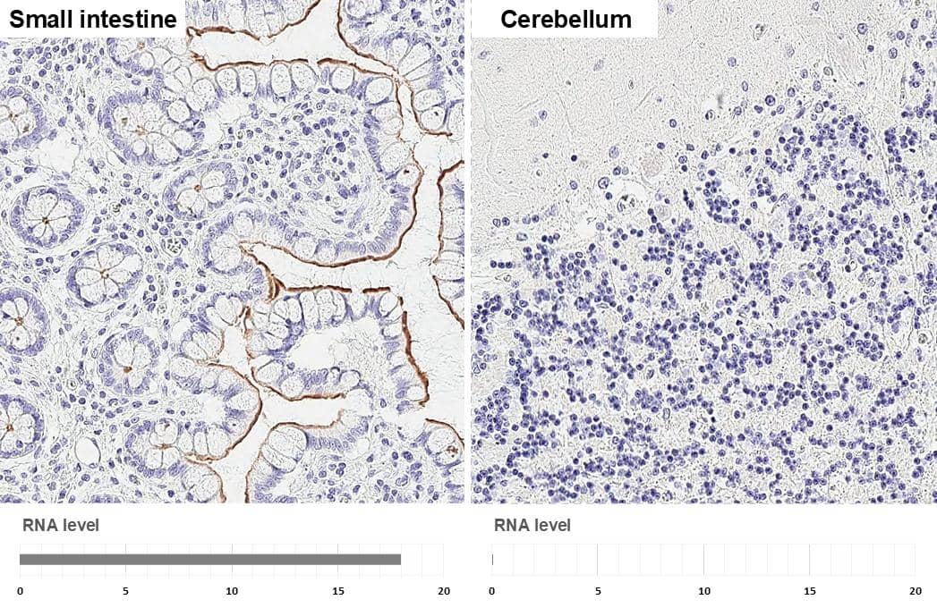 <b>Orthogonal Strategies Validation. </b>GPRC5A/RAI3 antibody [HL1864] detects GPRC5A/RAI3 protein by immunohistochemical analysis.Sample: Paraffin-embedded human tissues.GPRC5A/RAI3 stained by GPRC5A/RAI3 antibody [HL1864] (NBP3-25620) diluted at 1:100.Antigen Retrieval: Citrate buffer, pH 6.0, 15 min 