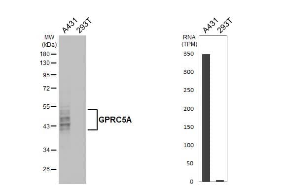 <b>Orthogonal Strategies Validation. </b>Various whole cell extracts (30 ug) were separated by 10% SDS-PAGE, and the membrane was blotted with GPRC5A/RAI3 antibody [HL1864] (NBP3-25620) diluted at 1:1000. The HRP-conjugated anti-rabbit IgG antibody was used to detect the primary antibody. Corresponding RNA expression data for the same cell lines are based on Human Protein Atlas program. 