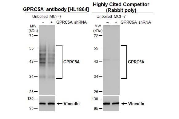 <b>Independent Antibodies Validation and Genetic Strategies Validation.</b>Non-transfected (-) and transfected (+) unboiled MCF-7 whole cell extracts (30 ug) were separated by 10% SDS-PAGE, and the membranes were blotted with GPRC5A/RAI3 antibody [HL1864] (NBP3-25620) diluted at 1:5000 and competitor's antibody (Competitor) diluted at 1:1000. The HRP-conjugated anti-rabbit IgG antibody was used to detect the primary antibody.*The competitor is not affiliated withand does not endorse this product. 
