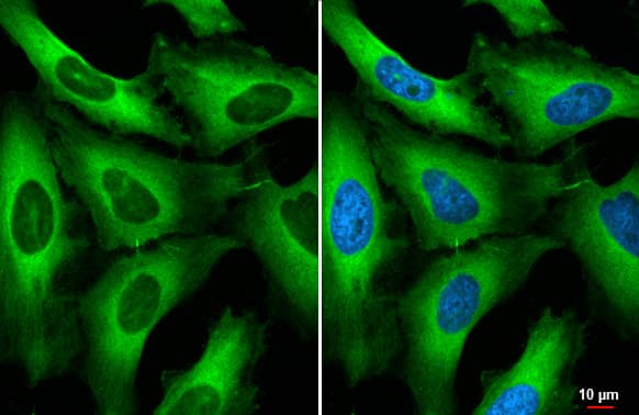 Immunocytochemistry/Immunofluorescence: RanBP1 Antibody (HL2358) - Azide and BSA Free [NBP3-25621] - RanBP1 antibody [HL2358] detects RanBP1 protein at cytoplasm by immunofluorescent analysis. Sample: HeLa cells were fixed in 4% paraformaldehyde at RT for 15 min. Green: RanBP1 stained by RanBP1 antibody [HL2358] (NBP3-25621) diluted at 1:500. Blue: Fluoroshield with DAPI .