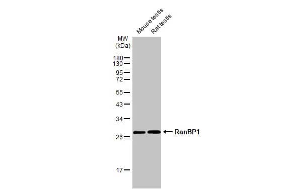 Western Blot: RanBP1 Antibody (HL2358) - Azide and BSA Free [NBP3-25621] - Various tissue extracts (50 ug) were separated by 12% SDS-PAGE, and the membrane was blotted with RanBP1 antibody [HL2358] (NBP3-25621) diluted at 1:1000. The HRP-conjugated anti-rabbit IgG antibody was used to detect the primary antibody.