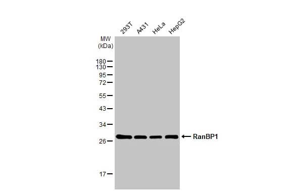 Western Blot: RanBP1 Antibody (HL2358) - Azide and BSA Free [NBP3-25621] - Various whole cell extracts (30 ug) were separated by 12% SDS-PAGE, and the membrane was blotted with RanBP1 antibody [HL2358] (NBP3-25621) diluted at 1:1000. The HRP-conjugated anti-rabbit IgG antibody was used to detect the primary antibody.