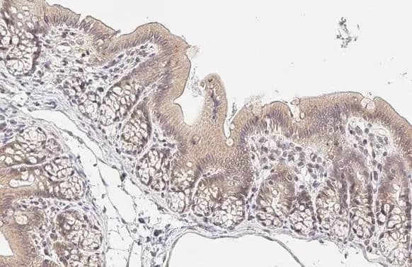 Immunohistochemistry-Paraffin: RelB Antibody (HL2222) - Azide and BSA Free [NBP3-25623] - RelB antibody [HL2222] detects RelB protein at cytoplasm and nucleus by immunohistochemical analysis. Sample: Paraffin-embedded rat colon. RelB stained by RelB antibody [HL2222] (NBP3-25623) diluted at 1:200. Antigen Retrieval: Citrate buffer, pH 6.0, 15 min