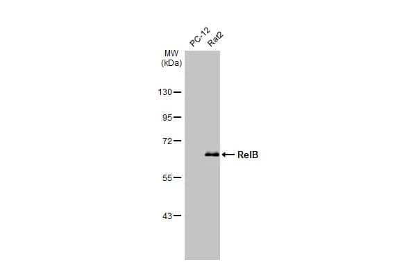 Western Blot: RelB Antibody (HL2222) - Azide and BSA Free [NBP3-25623] - Various whole cell extracts (30 ug) were separated by 7.5% SDS-PAGE, and the membrane was blotted with RelB antibody [HL2222] (NBP3-25623) diluted at 1:1000. The HRP-conjugated anti-rabbit IgG antibody was used to detect the primary antibody, and the signal was developed with Trident ECL plus-Enhanced.