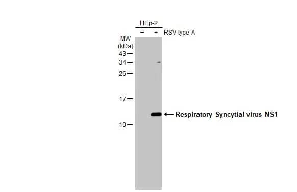Western Blot: Respiratory Syncytial Virus NS1 Antibody (HL2383) - Azide and BSA Free [NBP3-25624] - Non-infected (-) and infected (+) HEp-2 whole cell extracts (5 ug) were separated by 15% SDS-PAGE, and the membrane was blotted with Respiratory Syncytial virus NS1 antibody [HL2383] (NBP3-25624) diluted at 1:1000. The HRP-conjugated anti-rabbit IgG antibody was used to detect the primary antibody.