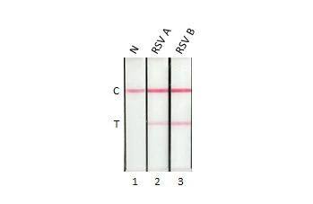 Detection of Respiratory Syncytial Virus Nucleoprotein by lateral flow assay using the monoclonal antibody pair. Capture: Respiratory Syncytial Virus Nucleoprotein antibody [HL1247] (NBP3-25627) Detection: Respiratory Syncytial Virus Nucleoprotein antibody [HL2182] 