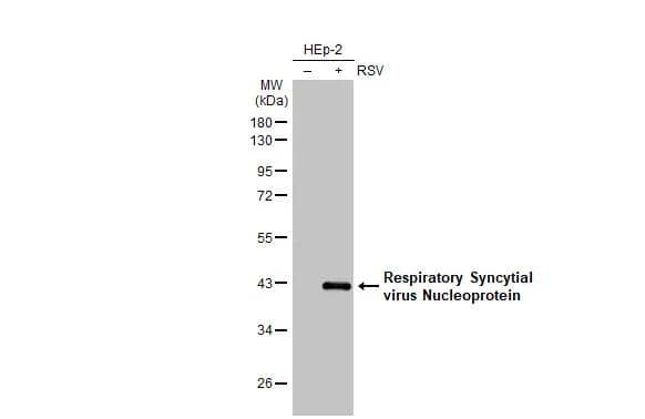 Non-infected (-) and infected (+) HEp-2 whole cell extracts (5 ug) were separated by 10% SDS-PAGE, and the membrane was blotted with Respiratory Syncytial Virus Nucleoprotein antibody [HL1247] (NBP3-25627) diluted at 1:25000. The HRP-conjugated anti-rabbit IgG antibody was used to detect the primary antibody. 